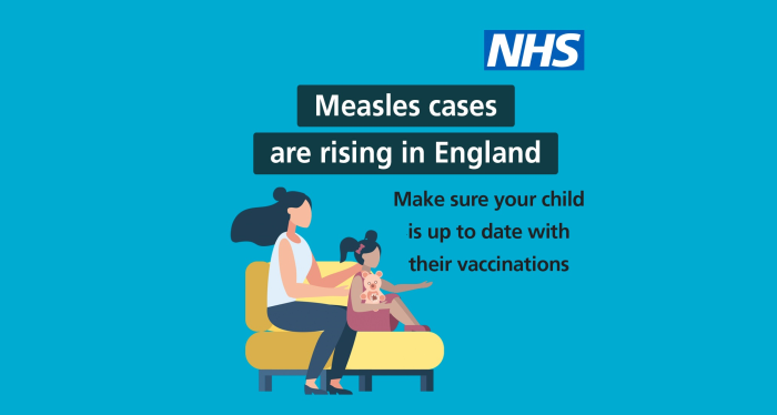 Measles cases are rising in England Make sure your child is up to date with their vaccinations. 